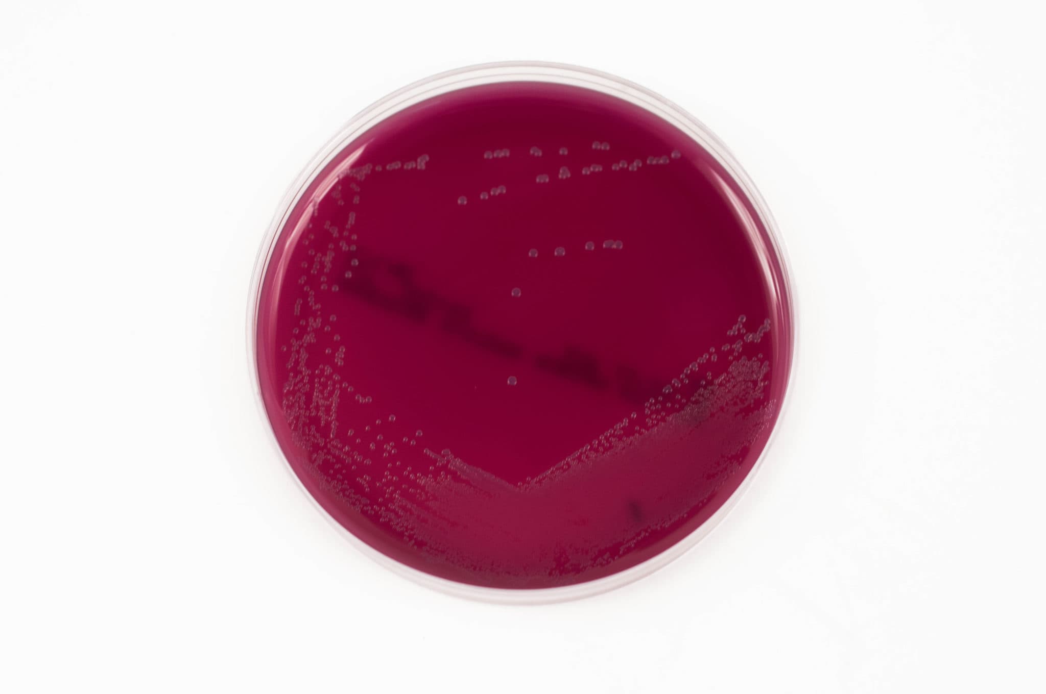 cristAL violet blood agar