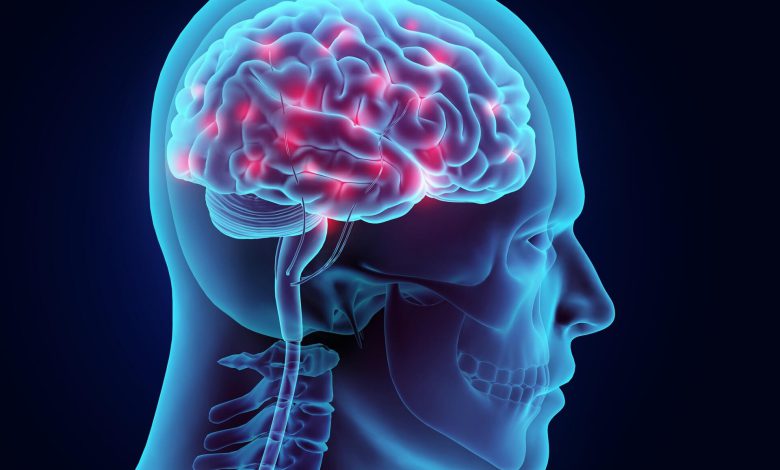 اختلالات مغزی - brain disorders