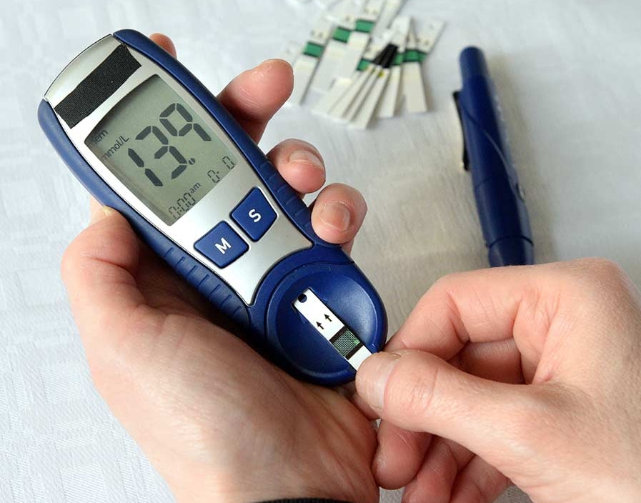آزمایش قند خون ناشتا یا Fasting blood sugar (FBS)