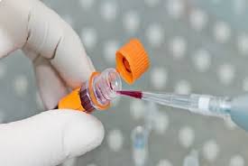 نمونه خون برای استخراج DNA