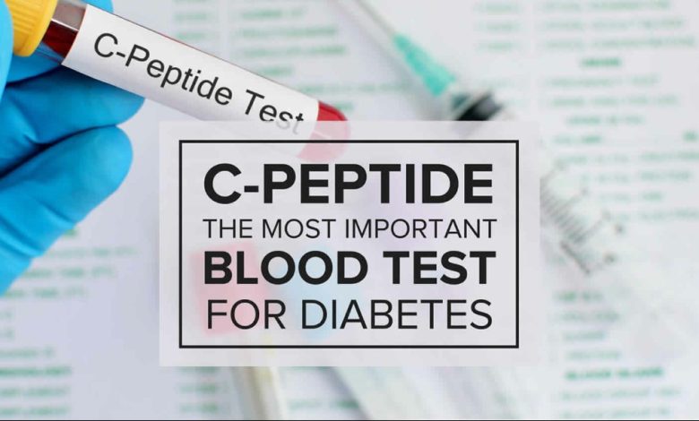 آزمایشc-peptide، آزمایشی مهم برای بررسی وجود دیابت