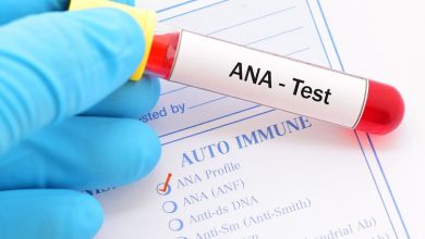 آزمایش آنتی‌­بادی­ های ضد هسته‌­ای (ANA test)