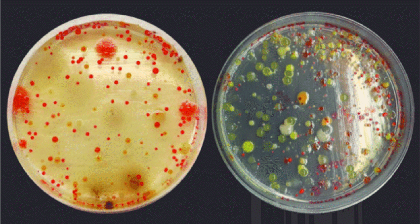  کلنی bacteria-colonies-on-agar-plate