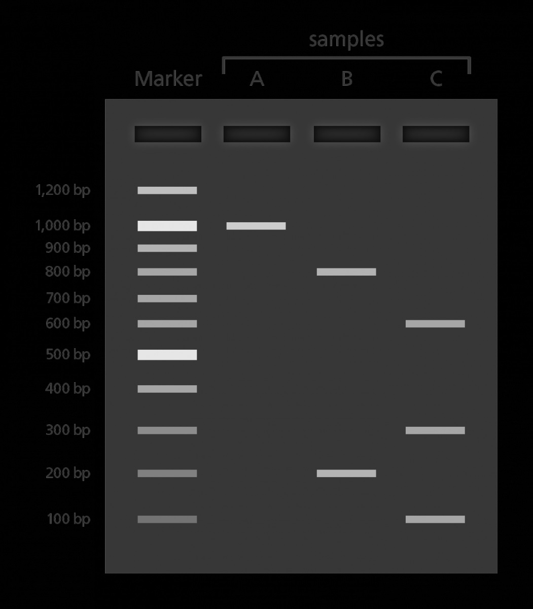 نمونه باندهای ژل الکتروفورز جهت تفسیر نتایج تکنیک PCR