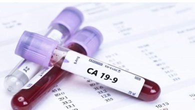 آزمایش خون CA 19-9