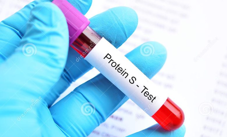test tube blood sample protein s coagulation disorder diagnosis 130984612 e1644078668201