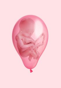 سرطان تخمدان ، تصویر جنین در بادکنک