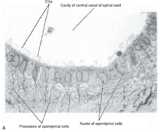 سلول‌های اپاندیم