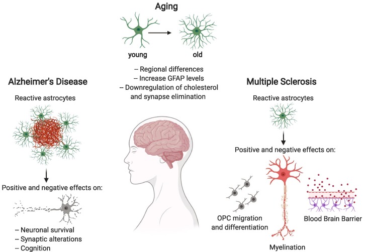 تأثیر متفاوت آستروسیت¬ها بر دو بیماری MS و آلزایمر
