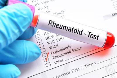 آزمایش RHEUMATOID ARTHRITIS FACTOR یا RF