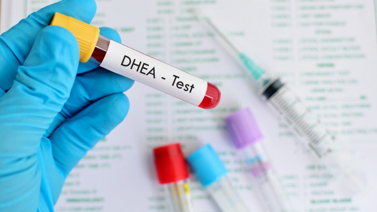 آزمایش خون(DHEA)