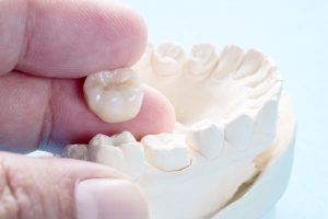 دندان عقل ، مورفولوژی دندان عقل