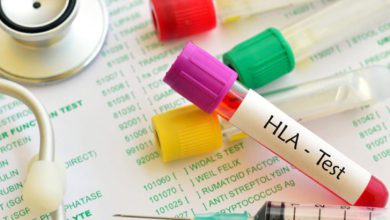 آزمایش HLA به‌صورت کلّی برای تشخیص بیماری‌های خود ایمنی مثل روماتیسم مفصلی یا آرتریت روماتوئید تجویز می‌شود.