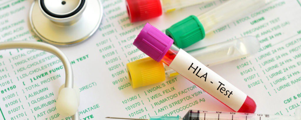آزمایش HLA به‌صورت کلّی برای تشخیص بیماری‌های خود ایمنی مثل روماتیسم مفصلی یا آرتریت روماتوئید تجویز می‌شود. 
