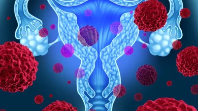 پیوند میکروبیوتای واژن و تاثیر آن در درمان بیماری‌های زنان