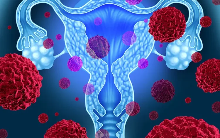 پیوند میکروبیوتای واژن و تاثیر آن در درمان بیماری‌های زنان